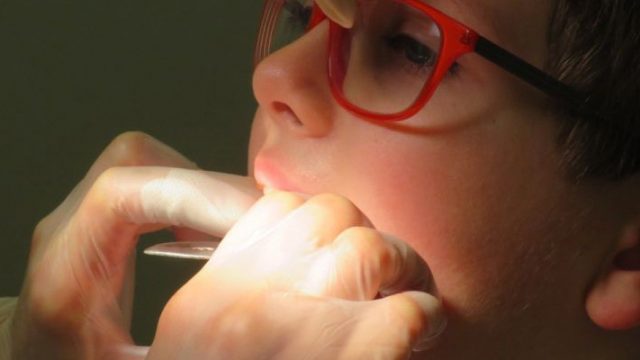 Orthodontie, quel est le bon moment pour le faire ?